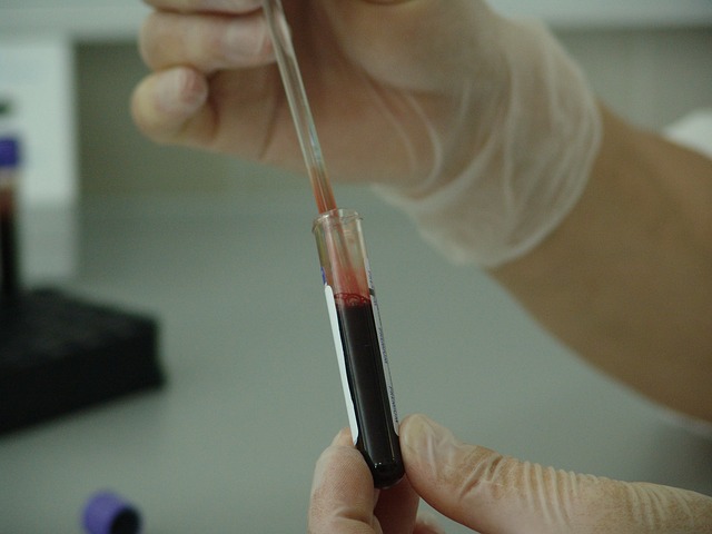 Celiac disease testing begins with blood tests that measure specific antibodies in the blood