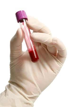 Photo with a hand holding a vial of blood, indicative of a screening blood test for celiac disease